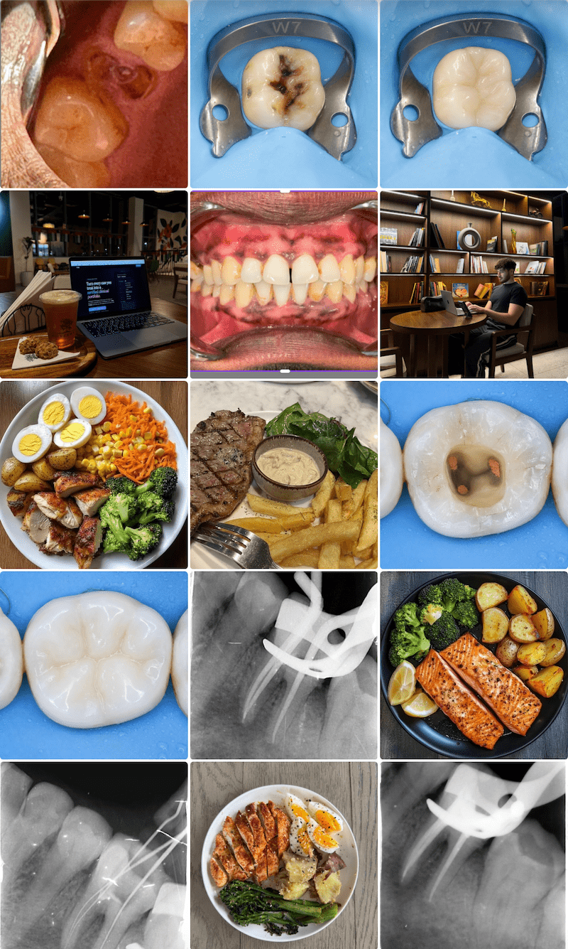 A dentist's camera roll — clinical photos mixed in with food, screenshots and everything else