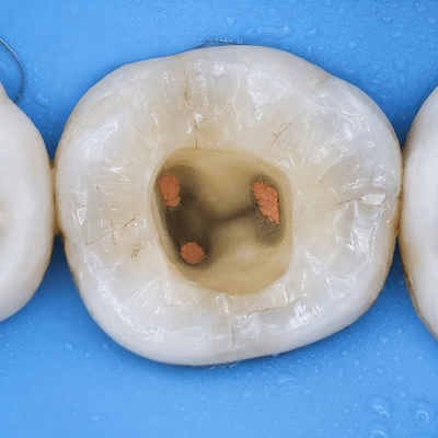Clinical photo