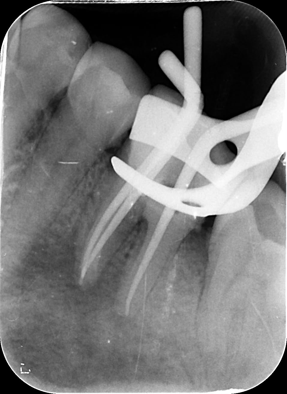 X-ray
